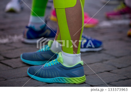 Close-up runner legs in kinesiotaping before marathon run 133373963