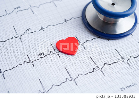 Electrocardiogram ECG, heart wave, heart attack, cardiogram report. Electrocardiogram ECG, heart wave, heart attack, cardiogram report. 133388933