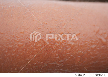 Close-up of skin with water droplets after exercise Close-up of skin with water droplets after exercise 133389644