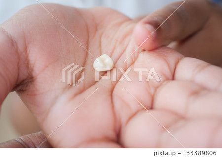 Child shows off a lost tooth in their palm 133389806