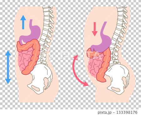 Visceroptosis: A condition in which the internal organs are lowered 133398176