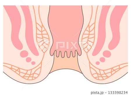 肛門の構造 直腸・肛門 断面図 肛門の構造 直腸・肛門 断面図 133398234