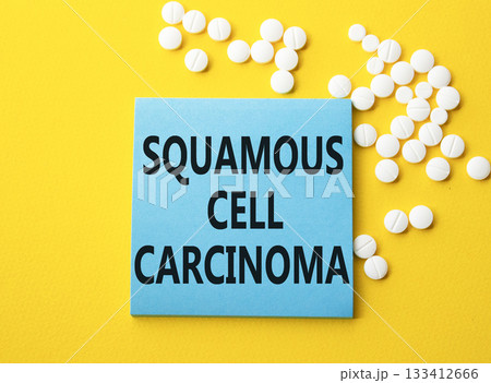 Squamous Cell Carcinoma symbol. Concept words Squamous Cell Carcinoma on blue note. Beautiful yellow background with pills. Healthcare and Squamous Cell Carcinoma concept. Copy space. Squamous Cell Carcinoma symbol. Concept words Squamous Cell Carcinoma on blue note. Beautiful yellow background with pills. Healthcare and Squamous Cell Carcinoma concept. Copy space. 133412666