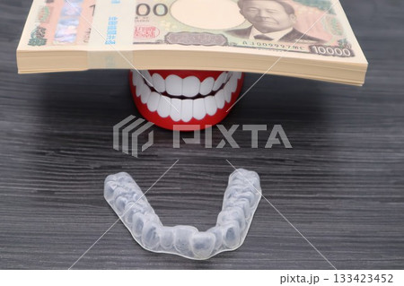 歯の矯正費用をイメージ 133423452