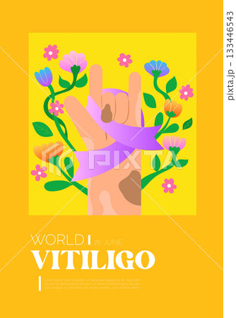 Vitiligo representation with hands and floral...のイラスト素材 [133446543] - PIXTA