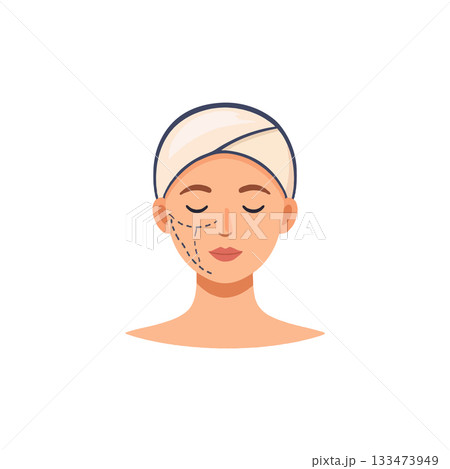 Woman undergoing cosmetic surgery preparation showcases facial markings for refined aesthetic 133473949