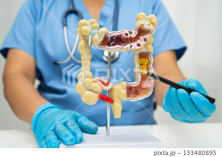 Intestine, Asian woman holding human anatomy model. 133480895