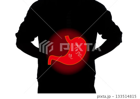 胃の病気 アニサキス 胃の病気 アニサキス 133514815