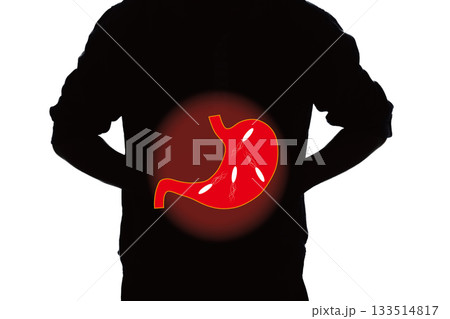 胃の病気 ピロリ菌 胃の病気 ピロリ菌 133514817