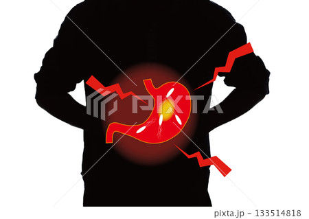 胃の病気　ピロリ菌　胃潰瘍 133514818