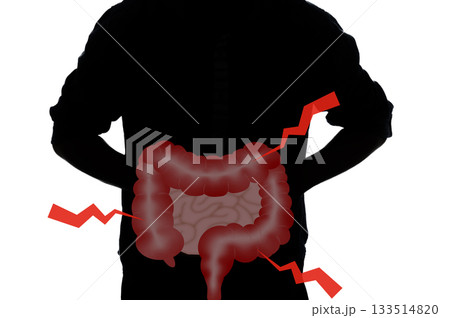 腸の病気 133514820