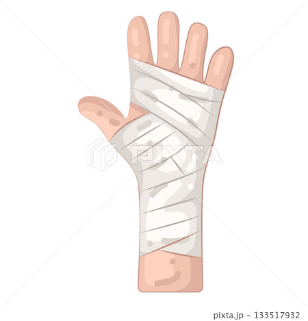 Illustration of hand injury  133517932