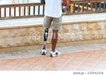 A man with a modern metal prosthesis instead of one leg 133542316