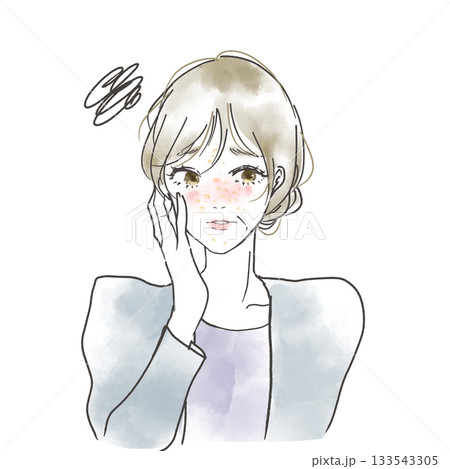 更年期で肌荒れに困っているミドル女性のイラスト 133543305