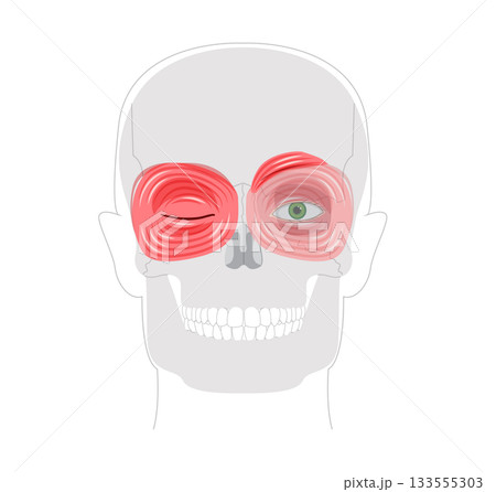 Face orbital region muscle chart, corrugator supercilii, orbicularis oculi palpebral orbital sections anatomical medical 133555303