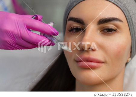 Injection procedure for lip augmentation, close-up. The cosmetologist slowly and carefully injects filler into the client lips. Advertising concept for facial care, youth and beauty 133558275