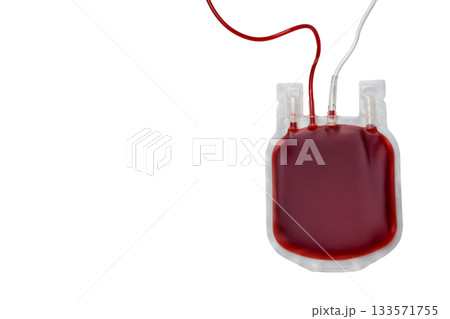 Bag containing red blood with medical tubing attached, isolated, PNG Bag containing red blood with medical tubing attached, isolated, PNG 133571755