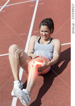 Highlighted bones of injured athlete Highlighted bones of injured athlete 133599427