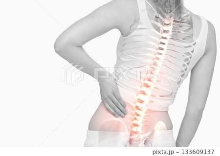 Highlighted spine of woman with back pain Highlighted spine of woman with back pain 133609137