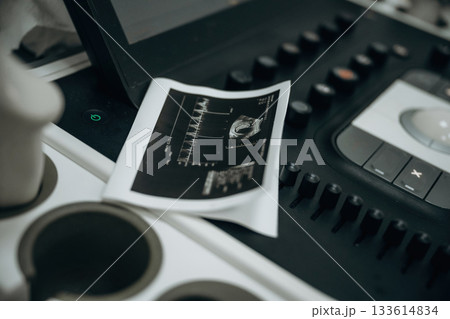 Ultrasonic machine, close up view, in the hospital room 133614834