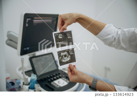Doctor is holding results of ultrasonic test in hands Doctor is holding results of ultrasonic test in hands 133614923