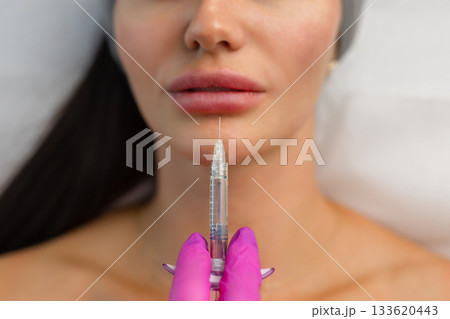Injection procedure for lip augmentation, close-up. The cosmetologist slowly and carefully injects filler into the client lips. Advertising concept for facial care, youth and beauty 133620443