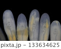 Clinostomum spp. are freshwater flukes with a worldwide distribution and a complex life cycle involving multiple hosts, including snails (intermediate hosts), fish or amphibians (secondary intermediat 133634625