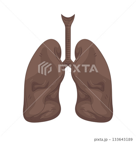 Illustration of unhealthy lungs 133643189