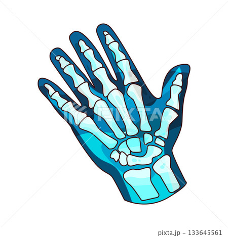 illustration of hand x-ray 133645561
