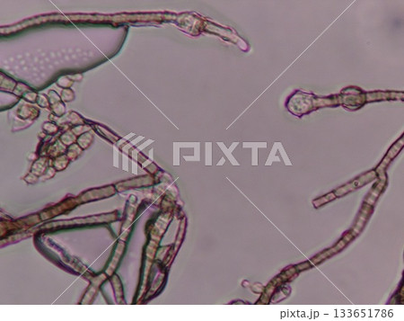胞子のうができてくる様子 133651786