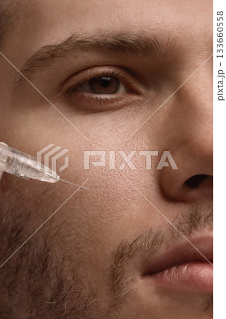 Doctor injecting dermal filler into male cheek for subtle contour refinement Doctor injecting dermal filler into male cheek for subtle contour refinement 133660558