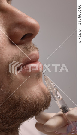 Doctor injecting filler to enhance male lip volume in close detailed view 133660560