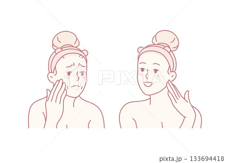 Woman before and after cosmetology procedures 133694418