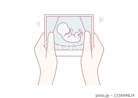 Tender fetal imagery, Soft muted colors depict bonding between parent and unborn child in artwork 133694624