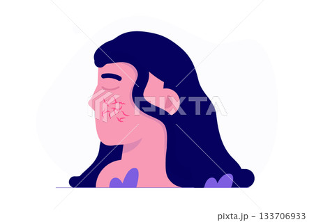 Woman Face with couperose or rosacea concept. Vector flat illustration isolated white background. 133706933