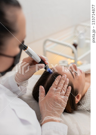 Trichologist doing woman hair regeneration procedure, dermapen microneedling, vitamin injections Trichologist doing woman hair regeneration procedure, dermapen microneedling, vitamin injections 133714877