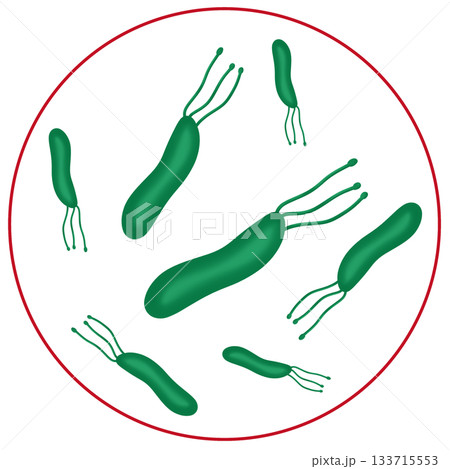 Helicobacter Pylori or H. Pylori Bacteria, Cause of Stomach Ulcers and Gastritis Helicobacter Pylori or H. Pylori Bacteria, Cause of Stomach Ulcers and Gastritis 133715553