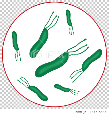 Helicobacter Pylori or H. Pylori Bacteria, Cause of Stomach Ulcers and Gastritis Helicobacter Pylori or H. Pylori Bacteria, Cause of Stomach Ulcers and Gastritis 133715553