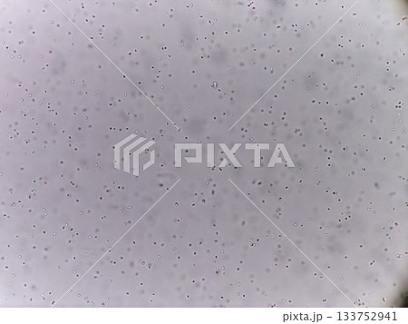 顕微鏡でみた酵母菌の様子 顕微鏡でみた酵母菌の様子 133752941