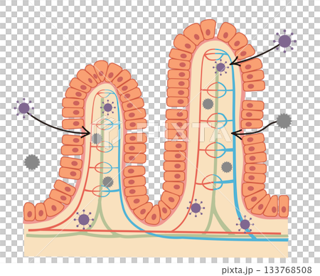 A cross-sectional illustration of small intestinal epithelial cells and an easy-to-understand illustration of leaky gut syndrome A cross-sectional illustration of small intestinal epithelial cells and an easy-to-understand illustration of leaky gut syndrome 133768508