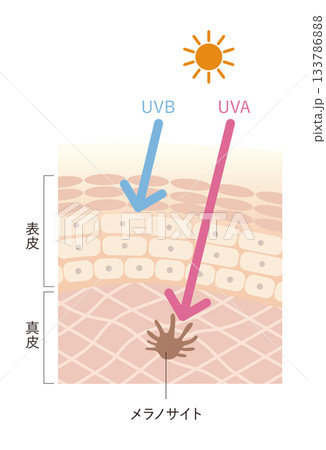 紫外線の影響 133786888
