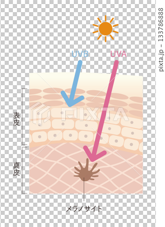 紫外線の影響 133786888