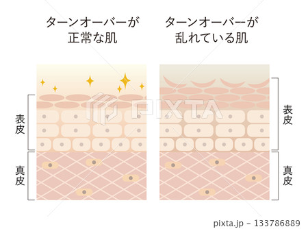 肌のターンオーバー 133786889