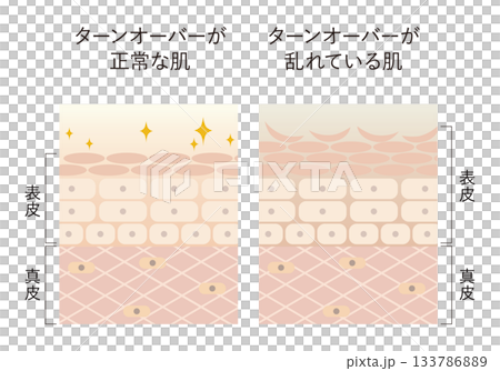 肌のターンオーバー 133786889