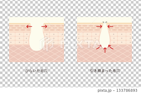 毛穴の開きと引き締め 133786893