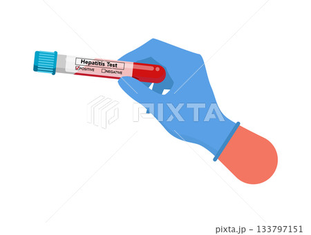 Hepatitis test vector stock illustration 133797151