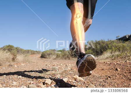 Runner experiencing leg pain 133806568
