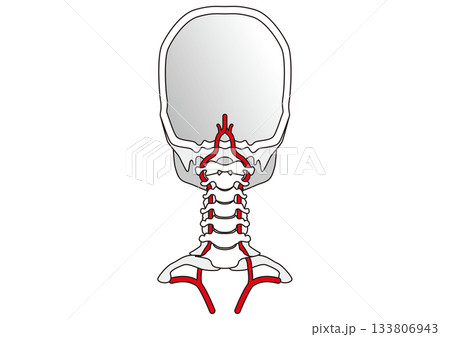 椎骨動脈 鎖骨下動脈 頸椎の横突孔 脳梗塞やくも膜下出血の原因 椎骨動脈 鎖骨下動脈 頸椎の横突孔 脳梗塞やくも膜下出血の原因 133806943