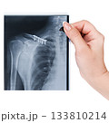 X-ray of the clavicle in a woman's hand isolated on a white background 133810214