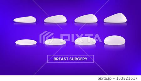Different types and sizes of silicone breast implants round shape and teardrop shape, vector plastic surgery infographic 133821617